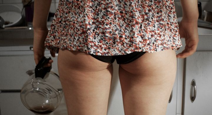 Eine repräsentative Umfrage der „Apotheken Umschau“ hat ergeben, dass Frauen sich nicht sonderlich an ihrer Orangenhaut stören.