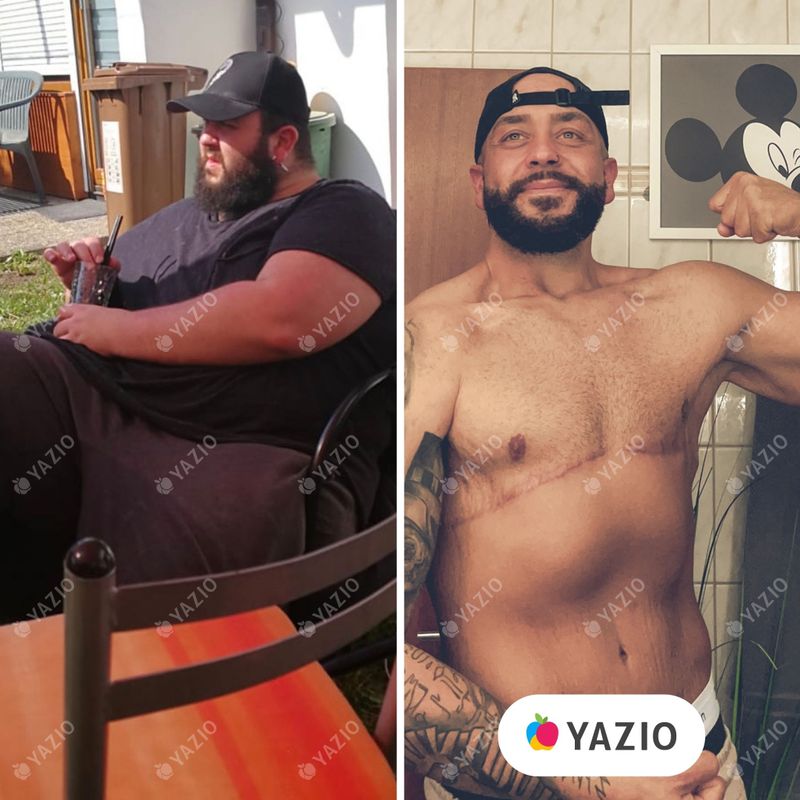 Samir perdeu 91 kg com o Yazio