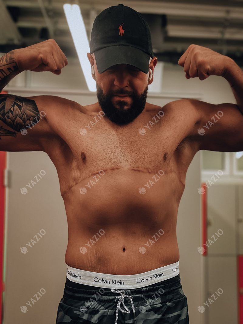 Samir perdeu 91 kg, a história de sucesso